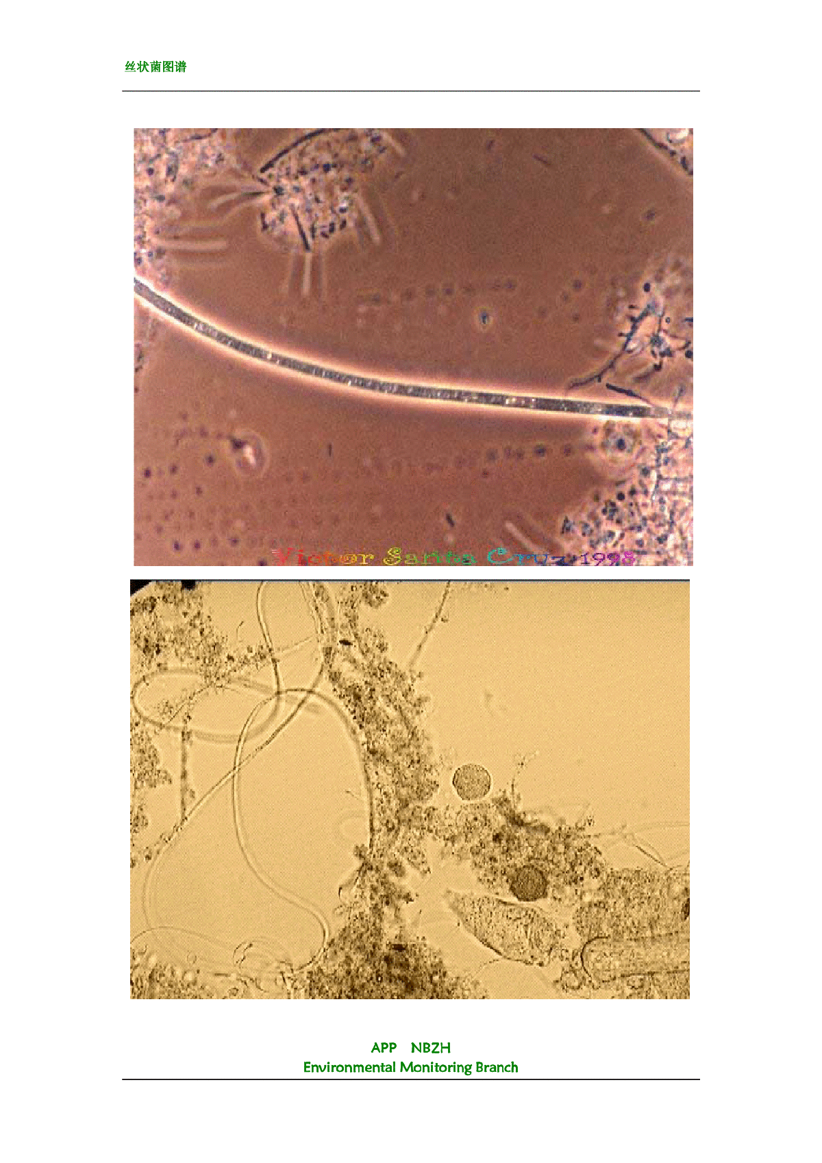 丝状菌革兰氏染色图片