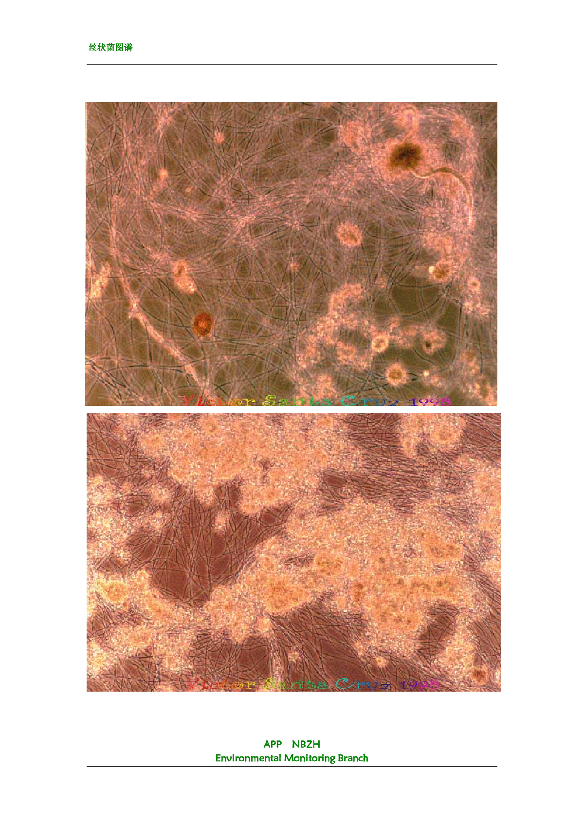 丝状菌图片显微镜图片